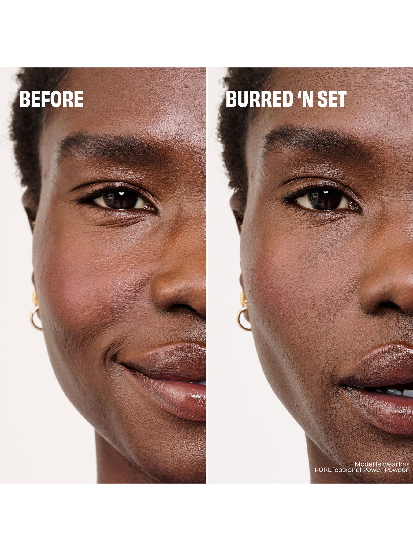 The POREfessional Set Up Pore Setting Set
