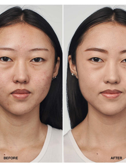 Even Better Clinical Serum Foundation SPF21