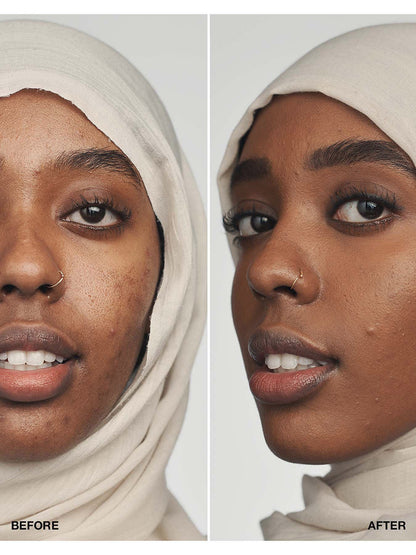 Even Better Clinical Serum Foundation SPF21