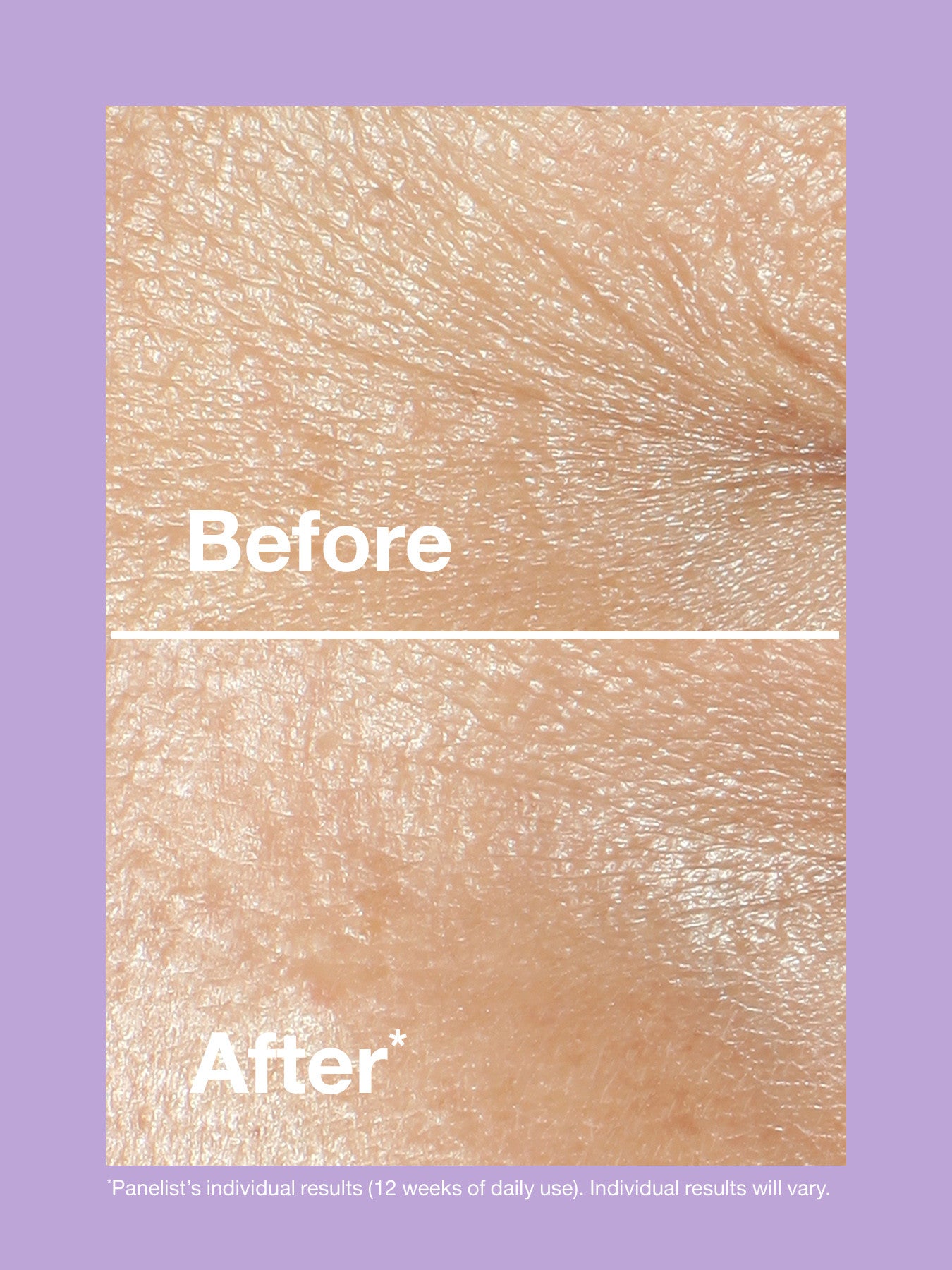 Smart Clinical Repair Wrinkle Cream All Skin Types 50ml