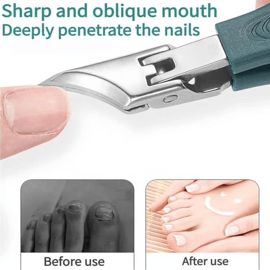 🔥Last Day Sale 49% OFF - 💅Eagle Beak Angled Nail Clippers 3-Piece Set